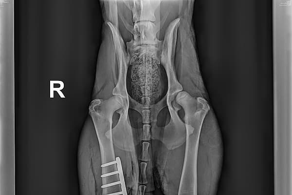 Radiographie du corps d’une personne.