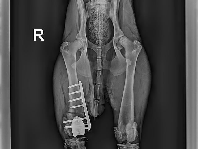 Radiographie du corps d’une personne.