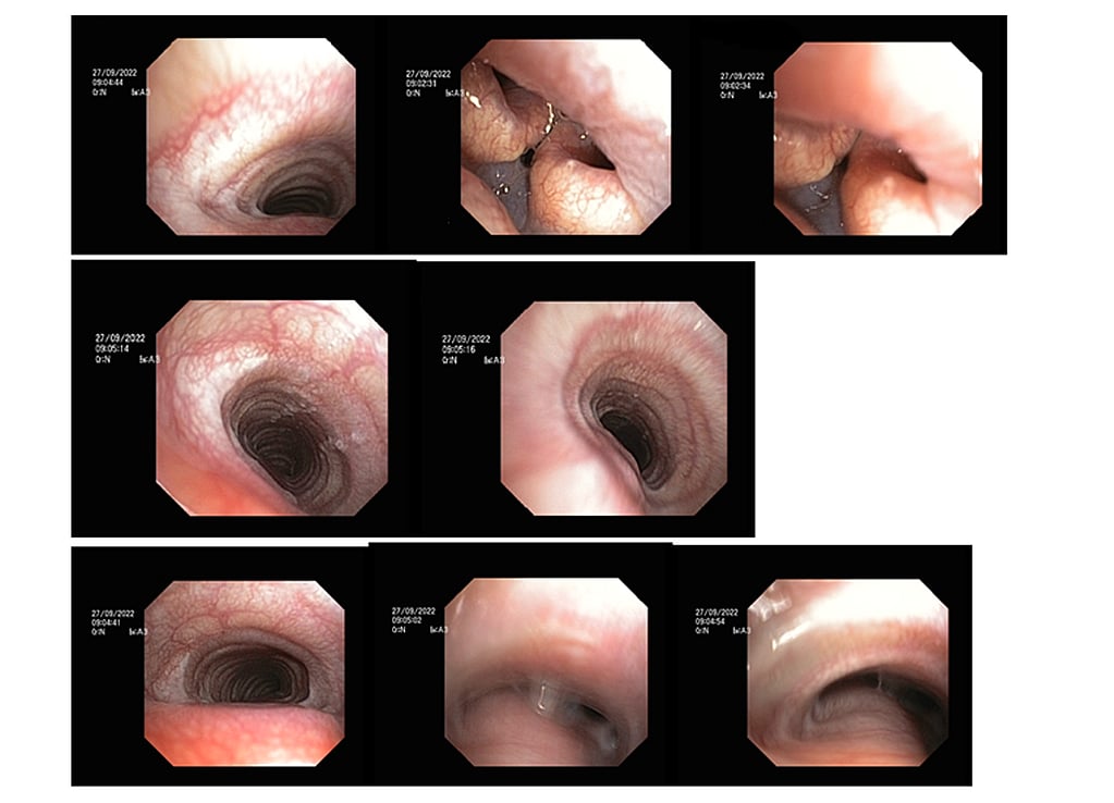 Un collage d’images du nez d’une personne.