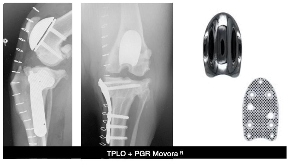 Radiographie d’une articulation du genou.
