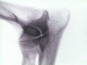 Radiographie d’un squelette d’Huperson.