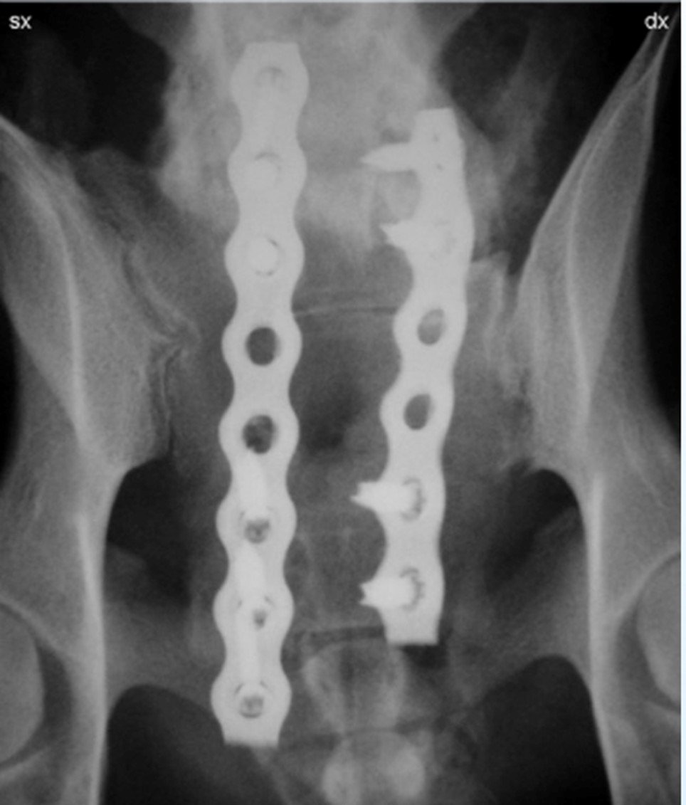 Radiographie d’une colonne vertébrale humaine.