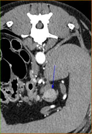 Gros plan d’une radiographie du corps d’une personne.